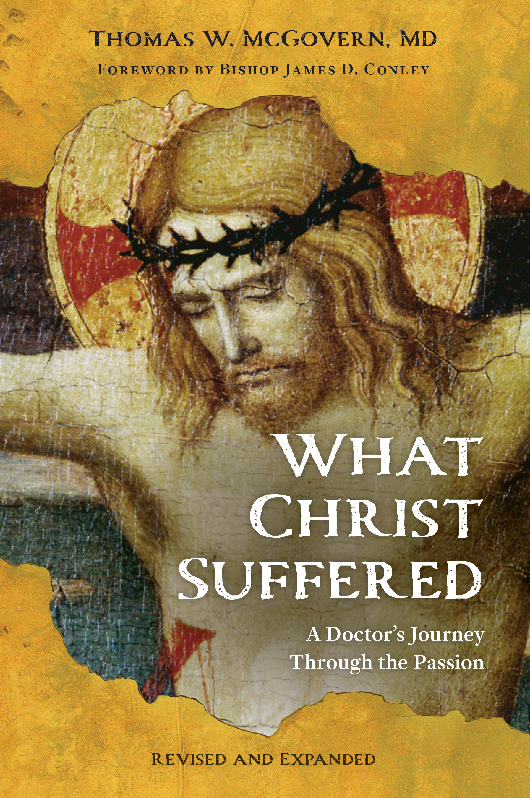 What Christ Suffered